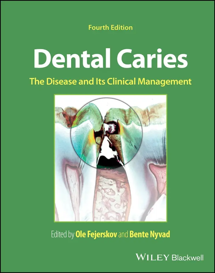 Dental Caries The Disease and Its Clinical Management 2025
